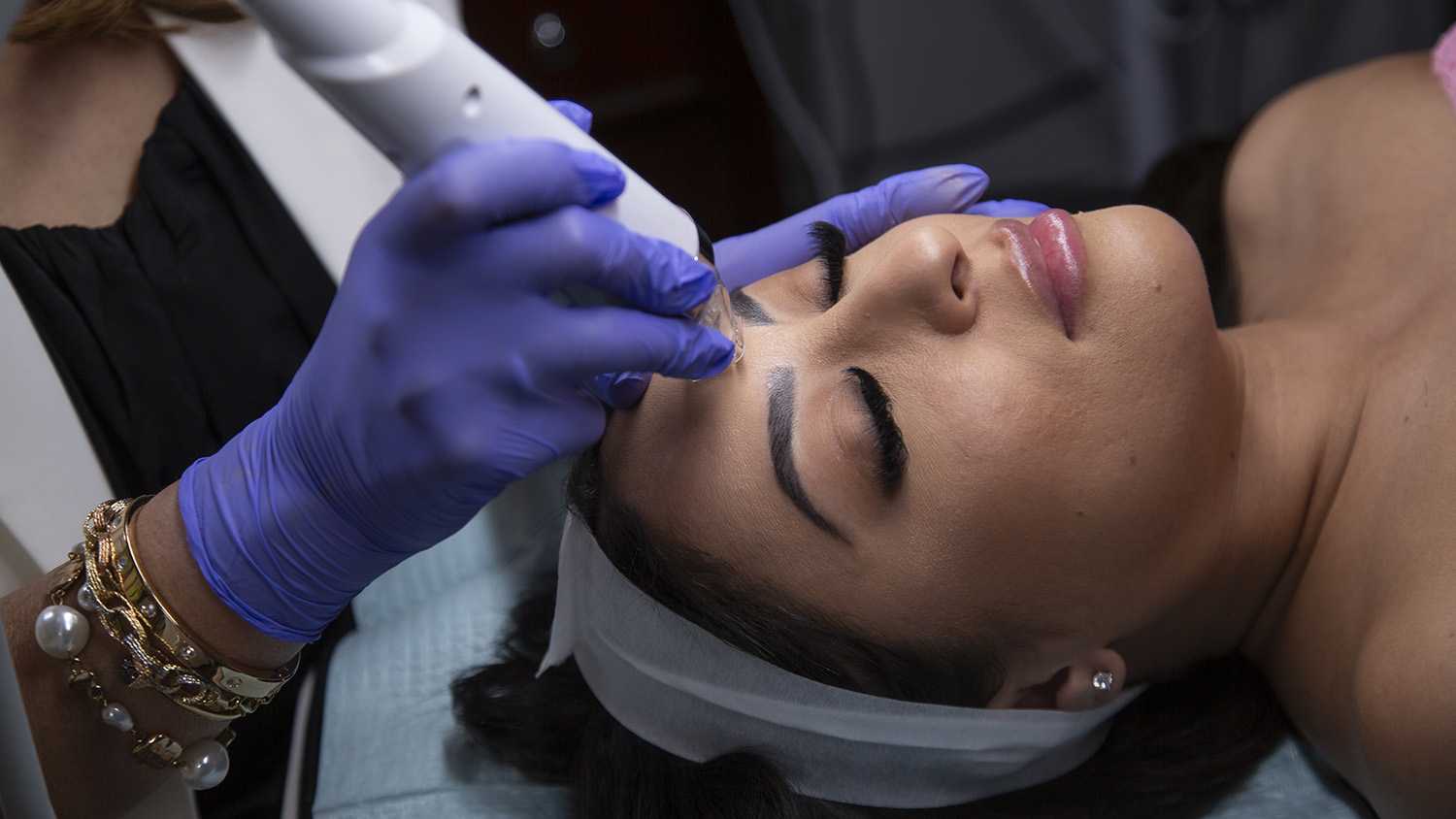 How long do Mirconeedling results last?